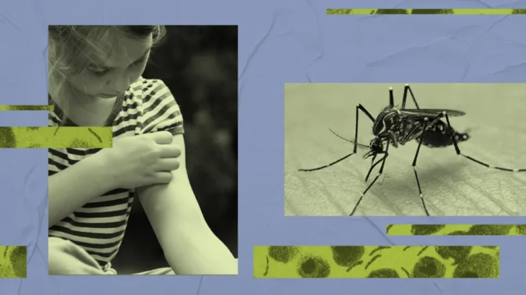 Dengue-fever-skin-header-1024x575