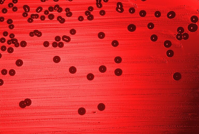 Haemophilus_influenzae_01