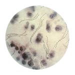 Haemophilus_ducreyi_01