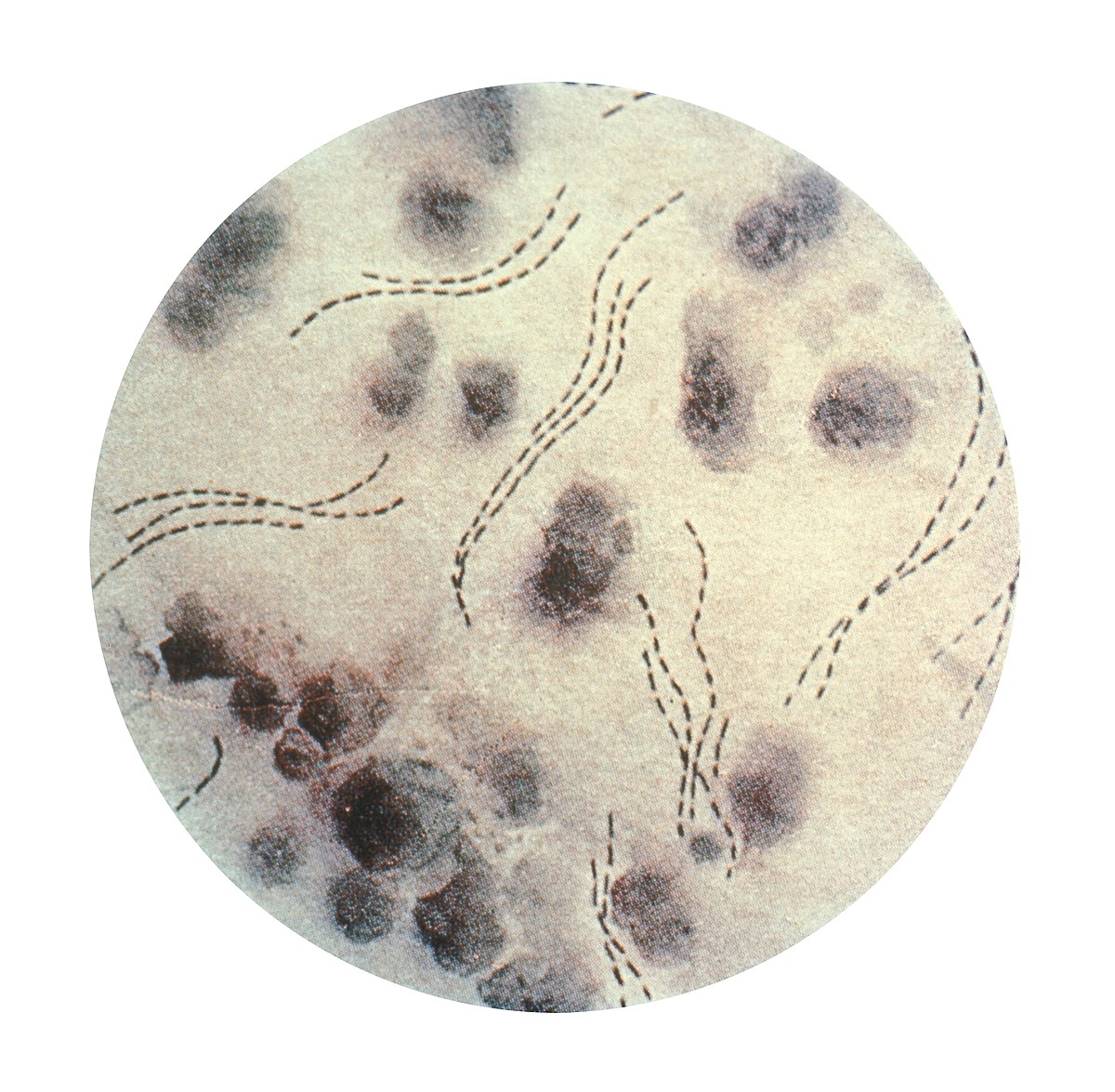 Haemophilus_ducreyi_01