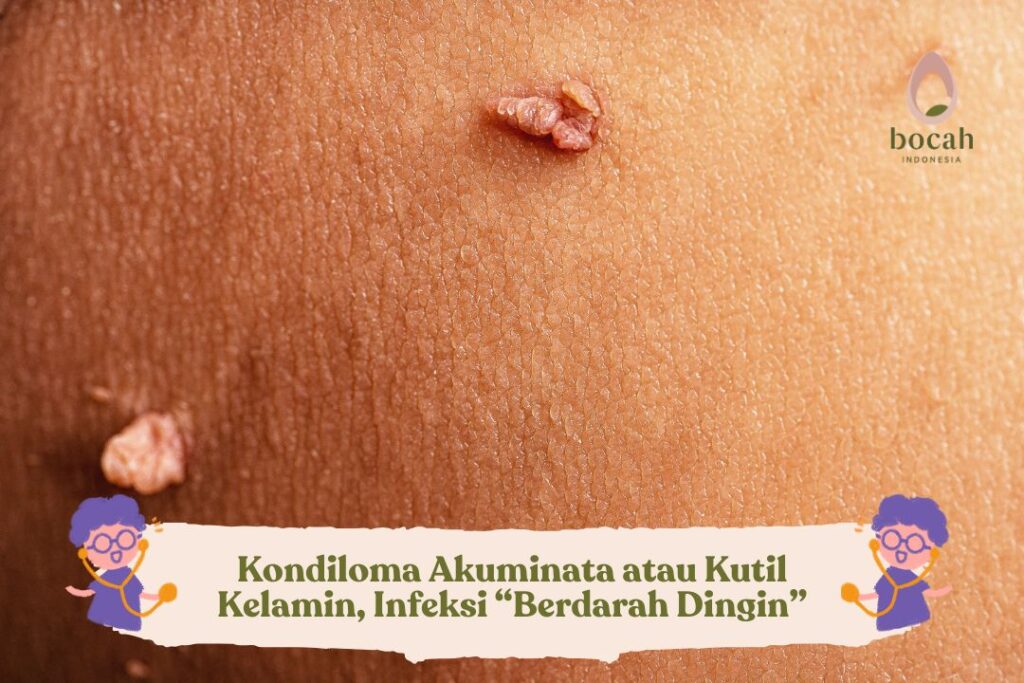 Kondiloma-Akuminata-atau-Kutil-Kelamin-Infeksi-Berdarah-Dingin-1024x683