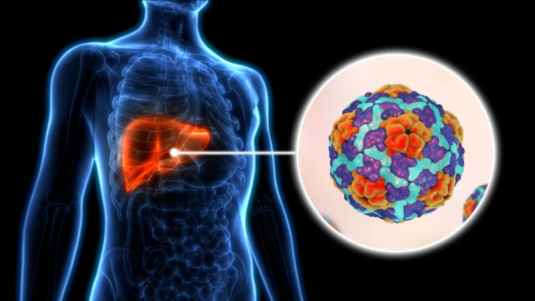 what-is-hepatitis-a-thumbnail