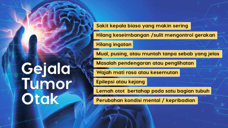 fakta-tentang-kesehatan-tumor-otak