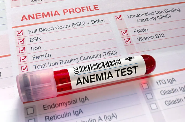 kesehatan-anemia-hemolitik-gejala-penyebab-dan-pengobatan