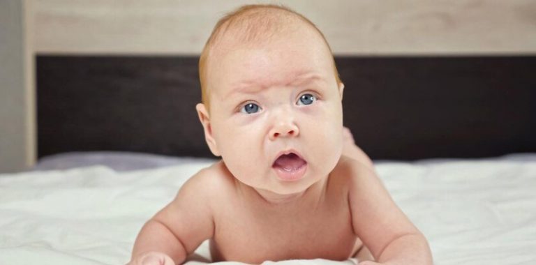 kesehatan-craniosynostosis-penyebab-gejala-dan-penanganan-terbaru