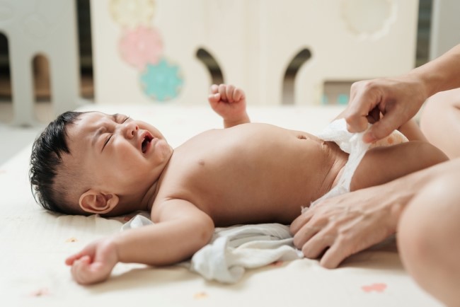 kesehatan-dan-penanganan-atresia-duodenum-pada-bayi