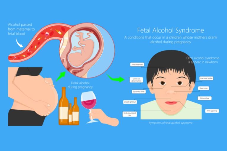 kesehatan-fetal-alcohol-syndrome-dampak-dan-pencegahannya