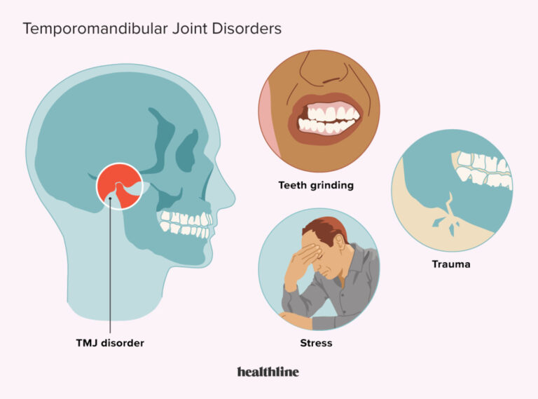 kesehatan-tmj-disorder-gejala-penyebab-dan-penanganannya
