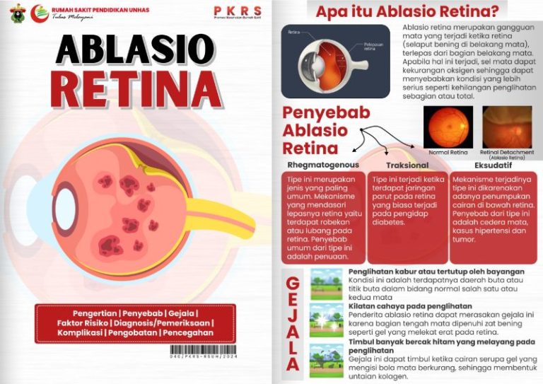 pemahaman-kesehatan-ablasi-retina-dan-penanganannya