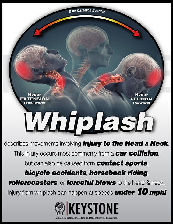 penjelasan-lengkap-tentang-cedera-whiplash