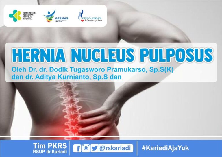 pentingnya-memahami-hernia-nukleus-pulposus