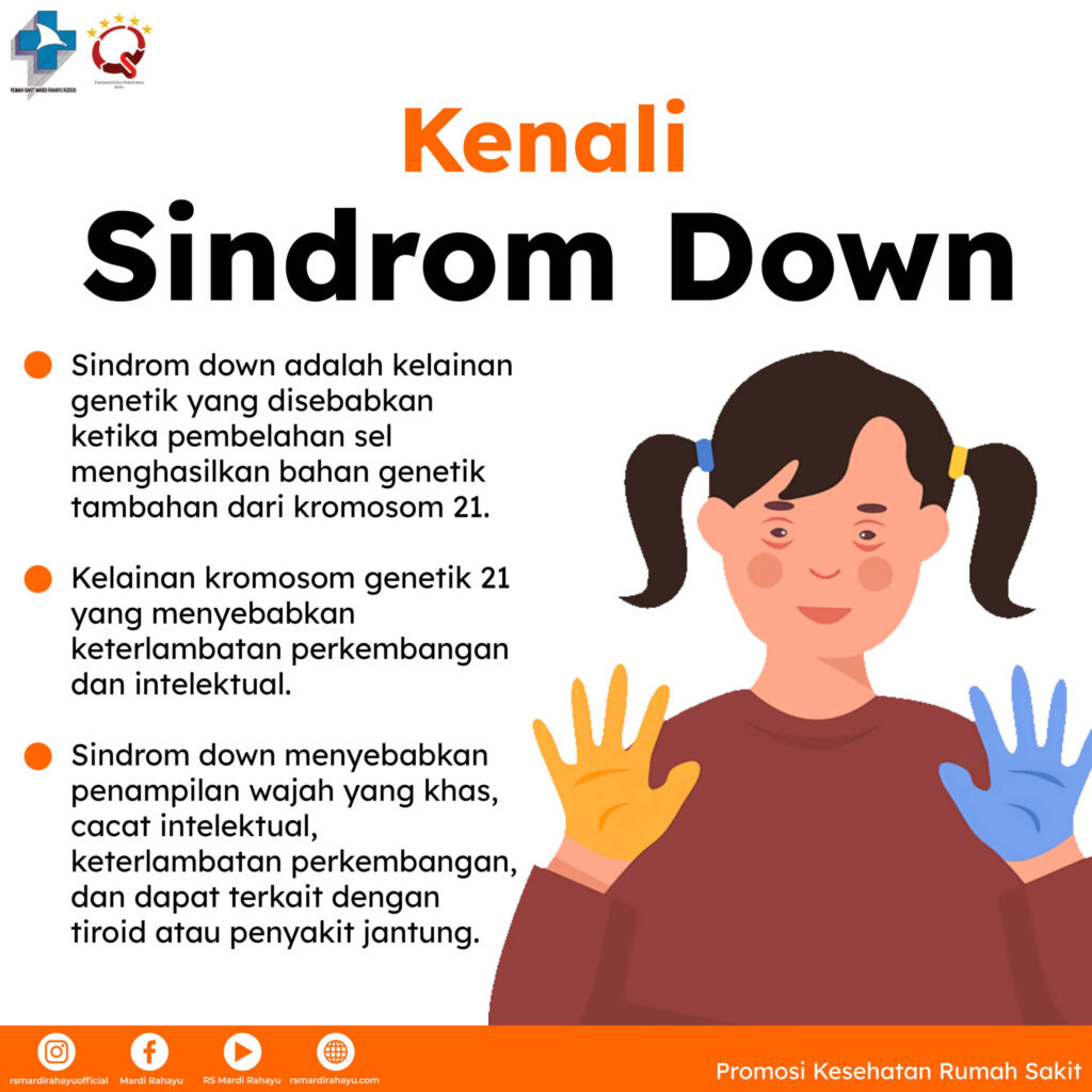 pentingnya-memahami-kesehatan-down-syndrome