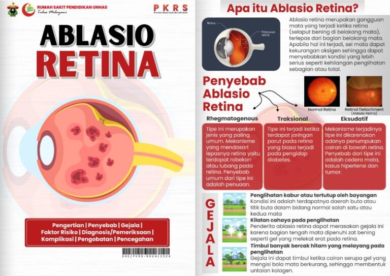 pentingnya-memahami-proses-ablasi-retina