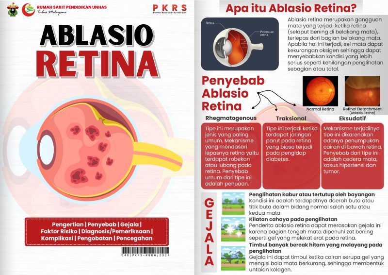 pentingnya-memahami-proses-ablasi-retina