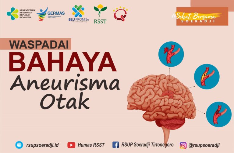 pentingnya-mengetahui-aneurisma-otak