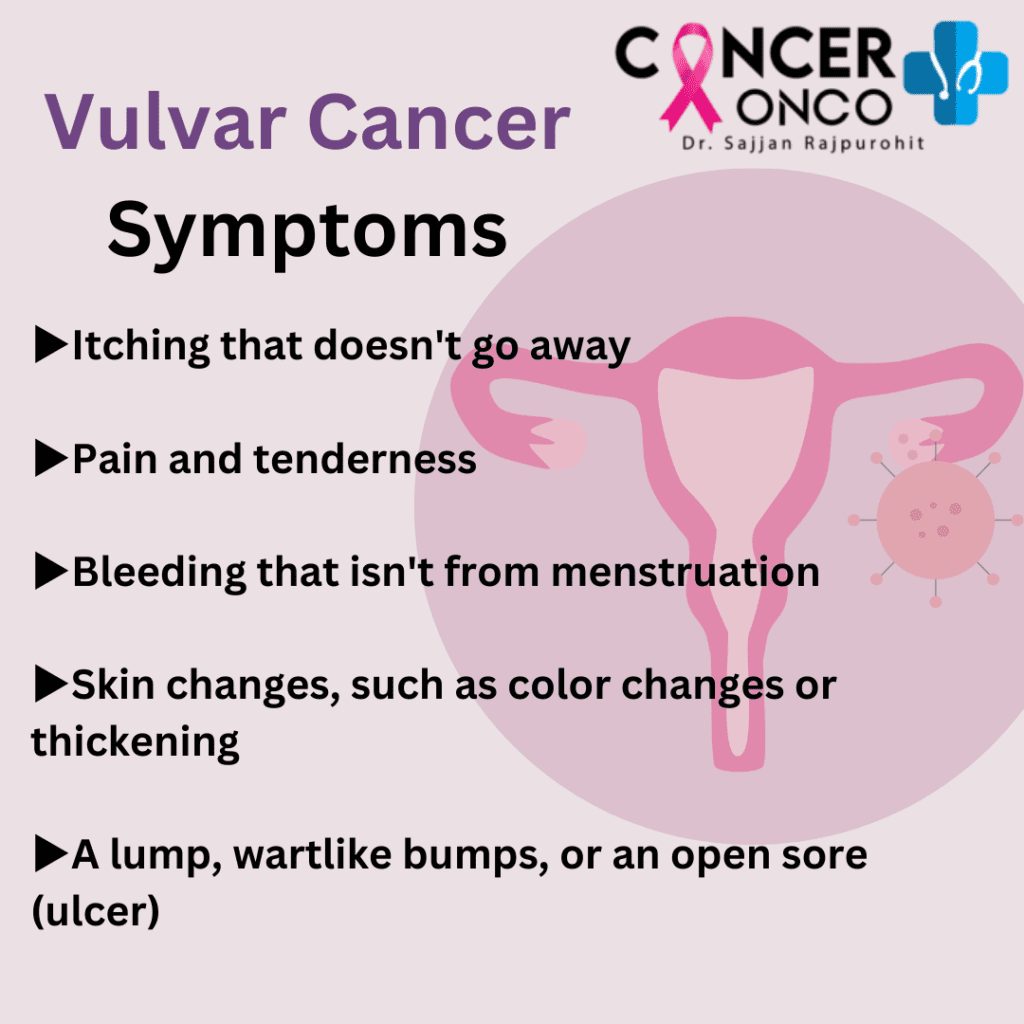 pentingnya-perawatan-kesehatan-kanker-vulva