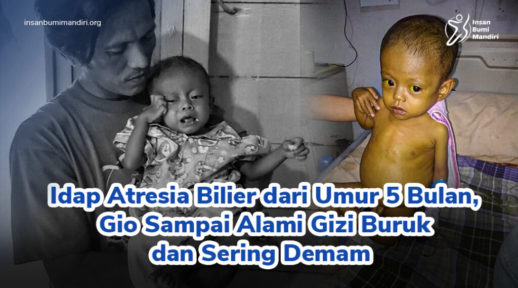 penyakit-langka-kesehatan-atresia-bilier