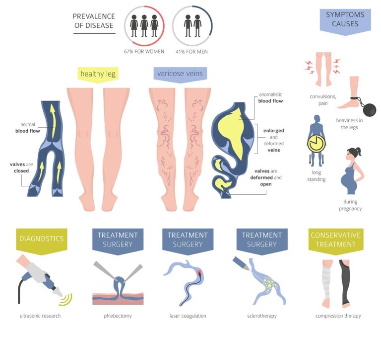 understanding-chronic-venous-insufficiency-causes-symptoms-and-treatment