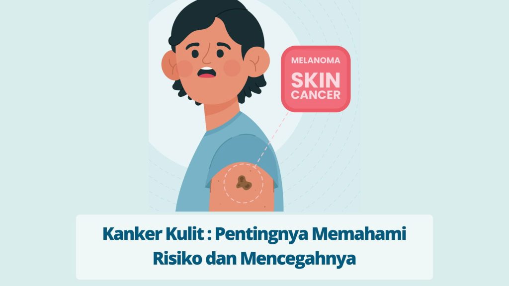 informasi-lengkap-tentang-kesehatan-dan-pencegahan-kanker-kulit