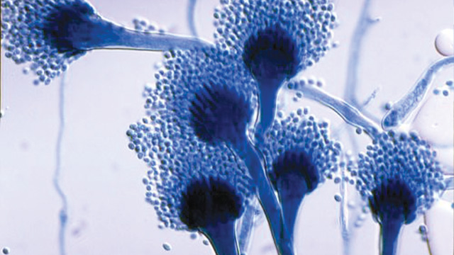 kesehatan-aspergillosis-penyakit-jamur-yang-perlu-diketahui