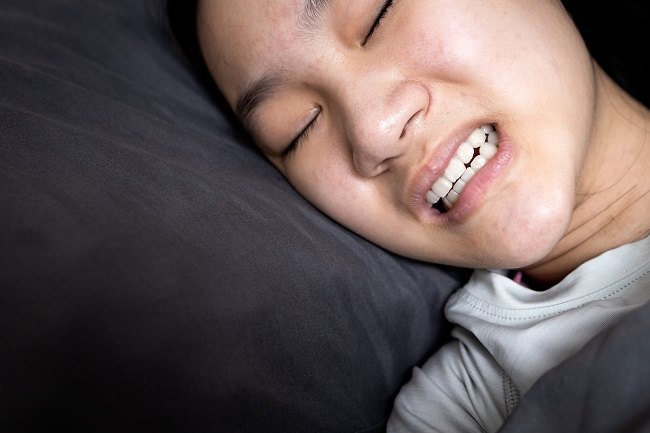kesehatan-bruxism-penyebab-gejala-dan-cara-mengatasinya