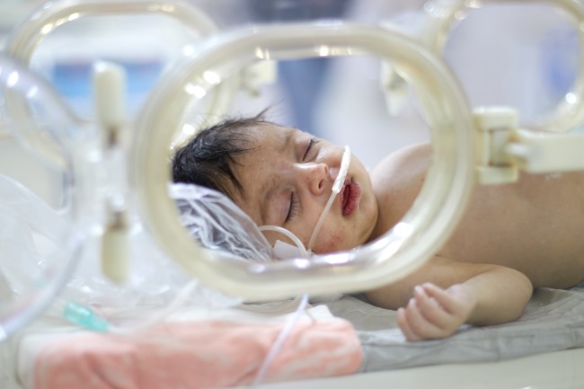 kesehatan-dan-penanganan-atresia-duodenum-pada-bayi