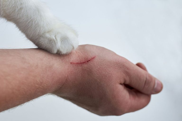 kesehatan-dan-penanganan-cat-scratch-disease-secara-lengkap