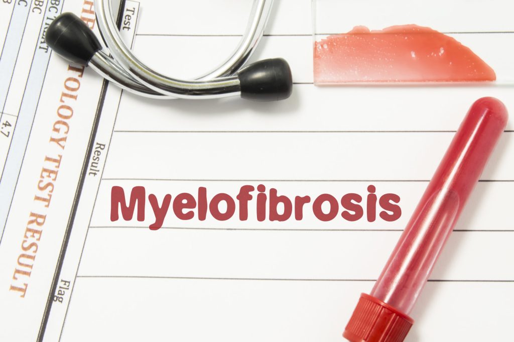 kesehatan-myelofibrosis-penjelasan-dan-informasi-penting
