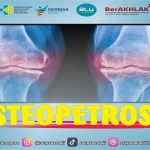 kesehatan-osteopetrosis-gejala-penyebab-dan-penanganannya