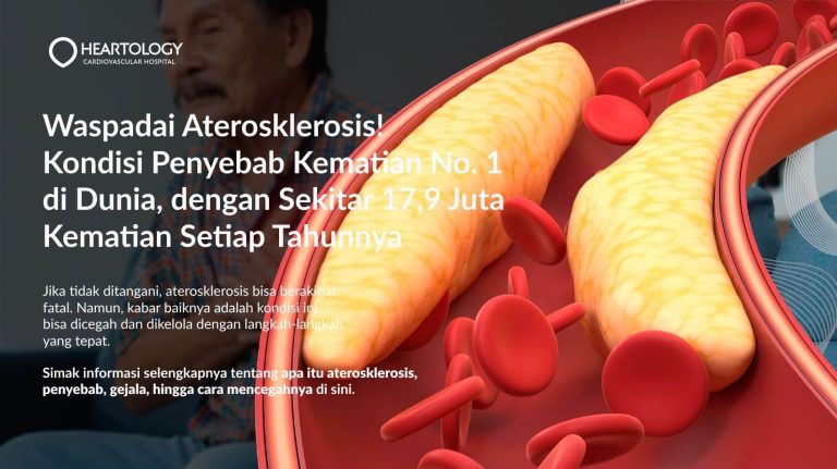 memahami-kesehatan-aterosklerosis-dan-cara-pencegahannya