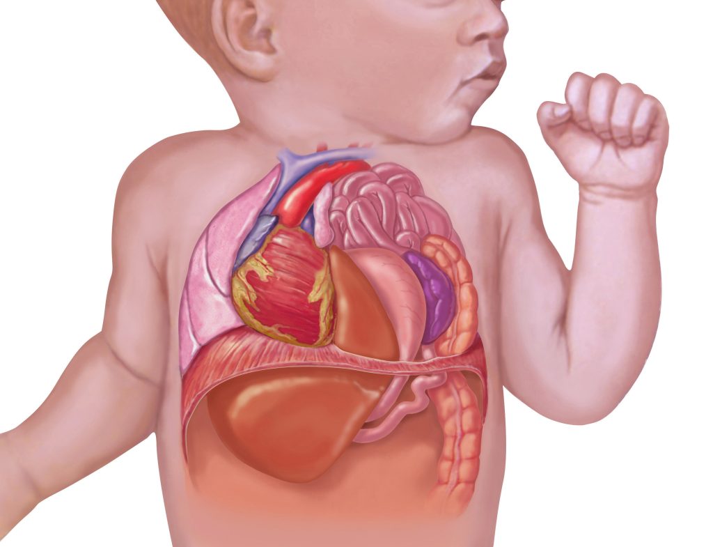mengenal-kesehatan-hernia-diafragma-gejala-dan-pengobatannya