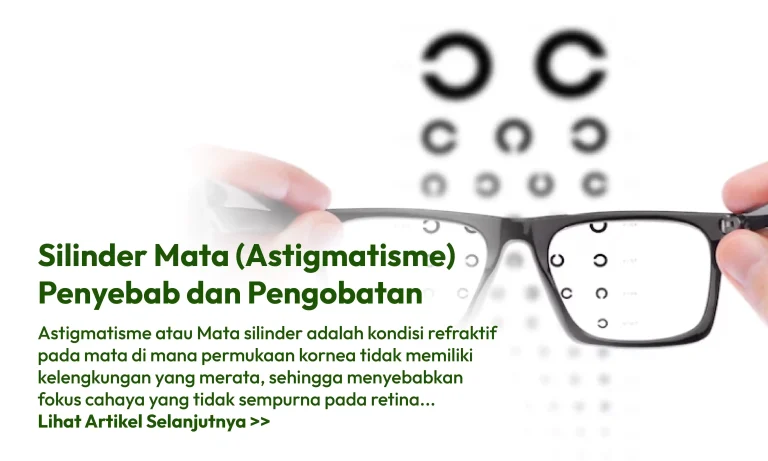 panduan-lengkap-tentang-kesehatan-dan-pengobatan-astigmatisme