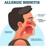 panduan-lengkap-tentang-kesehatan-rhinitis-alergi-dan-penanganannya