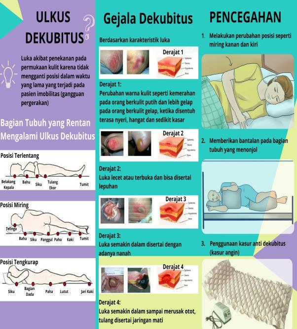 pemahaman-dan-penanganan-kesehatan-ulkus-dekubitus-yang-efektif