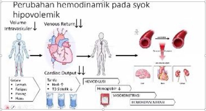 pemahaman-kesehatan-tentang-syok-hipovolemik-dan-penanganannya