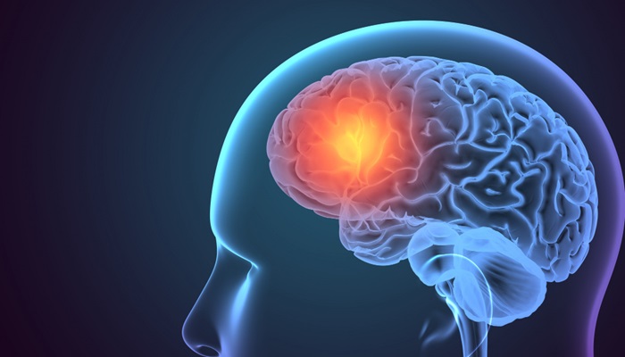 pemahaman-lengkap-tentang-kesehatan-tumor-otak-dan-penanganannya