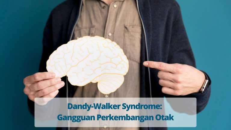 kesehatan-dan-penanganan-dandy-walker-syndrome-secara-lengkap
