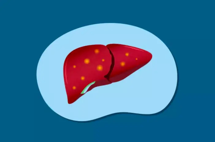 kesehatan-hemokromatosis-gejala-penyebab-dan-penanganan