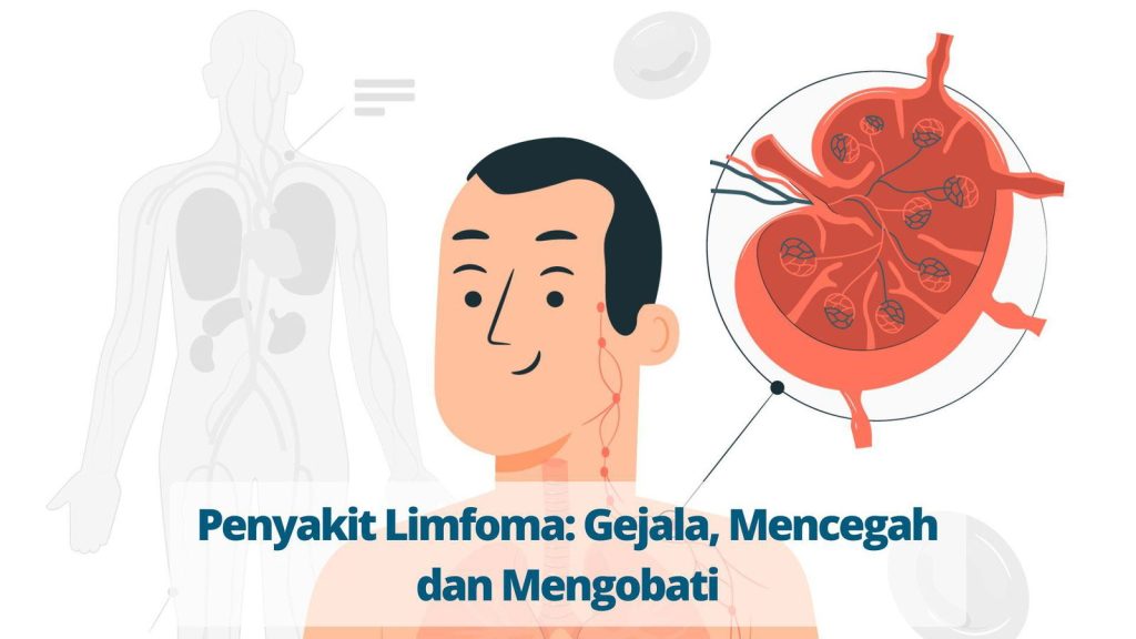kesehatan-limfoma-hodgkin-penjelasan-dan-perawatan-terbaru