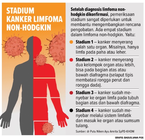 kesehatan-limfoma-non-hodgkin-gejala-penyebab-dan-penanganan