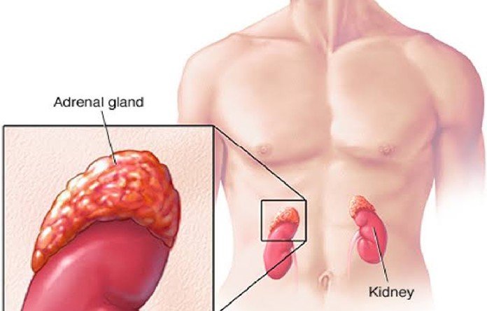 kesehatan-neuroblastoma-pemahaman-dan-penanganan-penyakit-anak