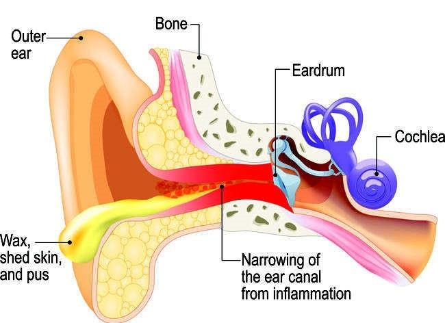 kesehatan-otitis-eksterna-penyebab-gejala-dan-pengobatan