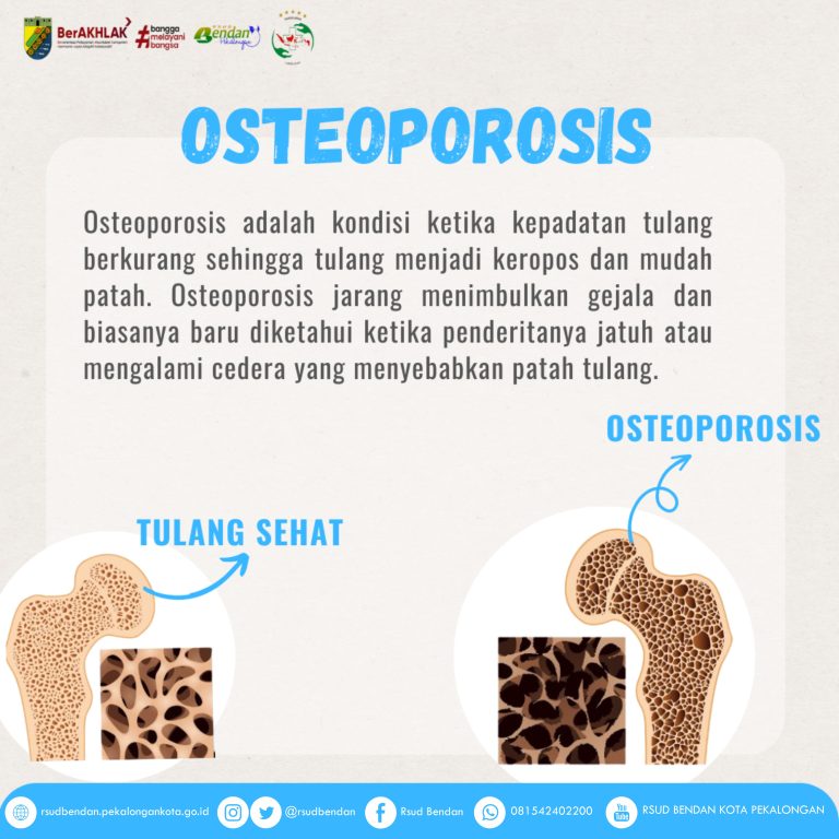 mengenal-kesehatan-osteoporosis-penyebab-gejala-dan-pencegahannya