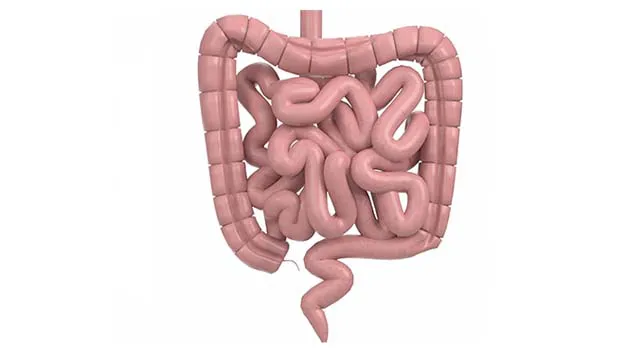 pemahaman-kesehatan-ileus-paralitik-gejala-penyebab-dan-pengobatan
