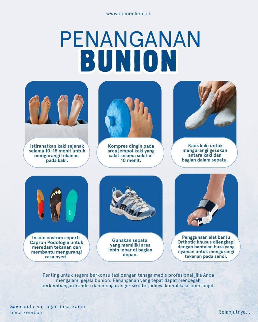 penjelasan-lengkap-tentang-kesehatan-bunion-dan-cara-pencegahannya