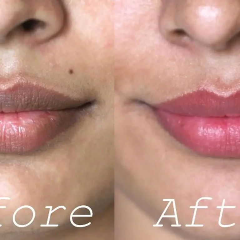 tips-menjaga-kesehatan-bibir-hitam-secara-alami