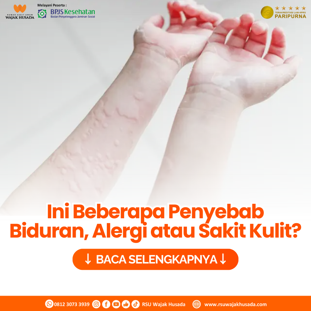 pengertian-dan-gejala-kesehatan-biduran-secara-lengkap